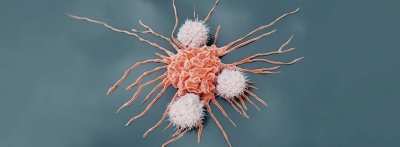 En sık görülen kanser türleri açıklandı