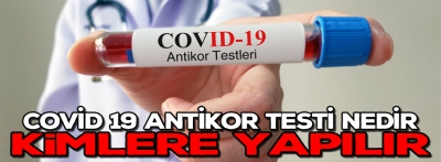 COVİD-19 Antikor testi nedir 