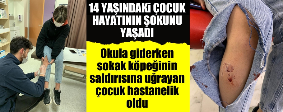 Sokak köpeği okula giden çocuğa saldırdı