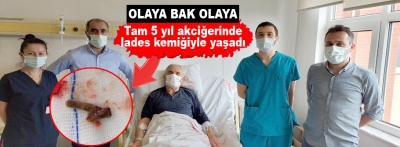 5 yıl akciğerine saplanan lades kemiğiyle yaşamış