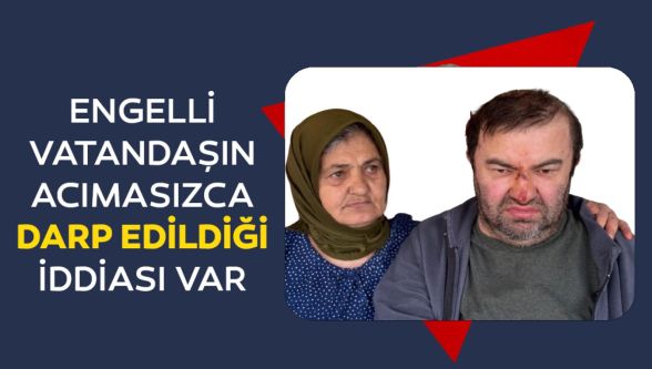 Yüzde 90 engelli vatandaşın acımasızca darp edildiği iddiası var