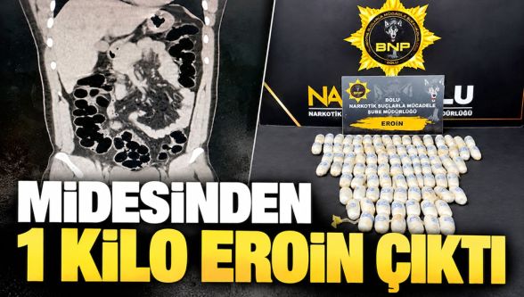 Midesinde 89 kapsül eroinle yola çıktı! Yolculuk cezaevinde bitti